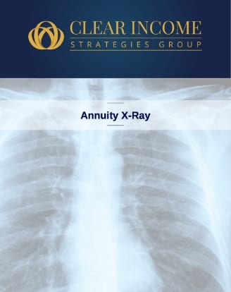 Annuity X-Ray